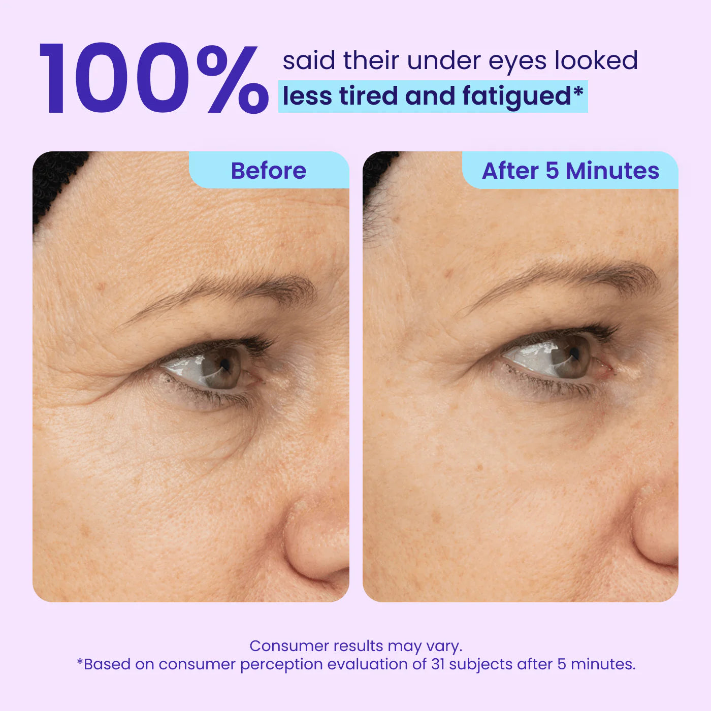 GOPURE | Gel Liftant Instantané pour les Yeux