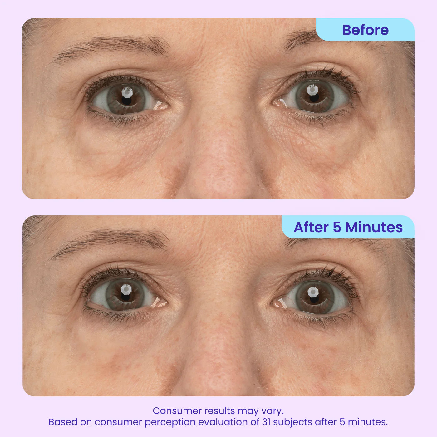 GOPURE | Gel Liftant Instantané pour les Yeux