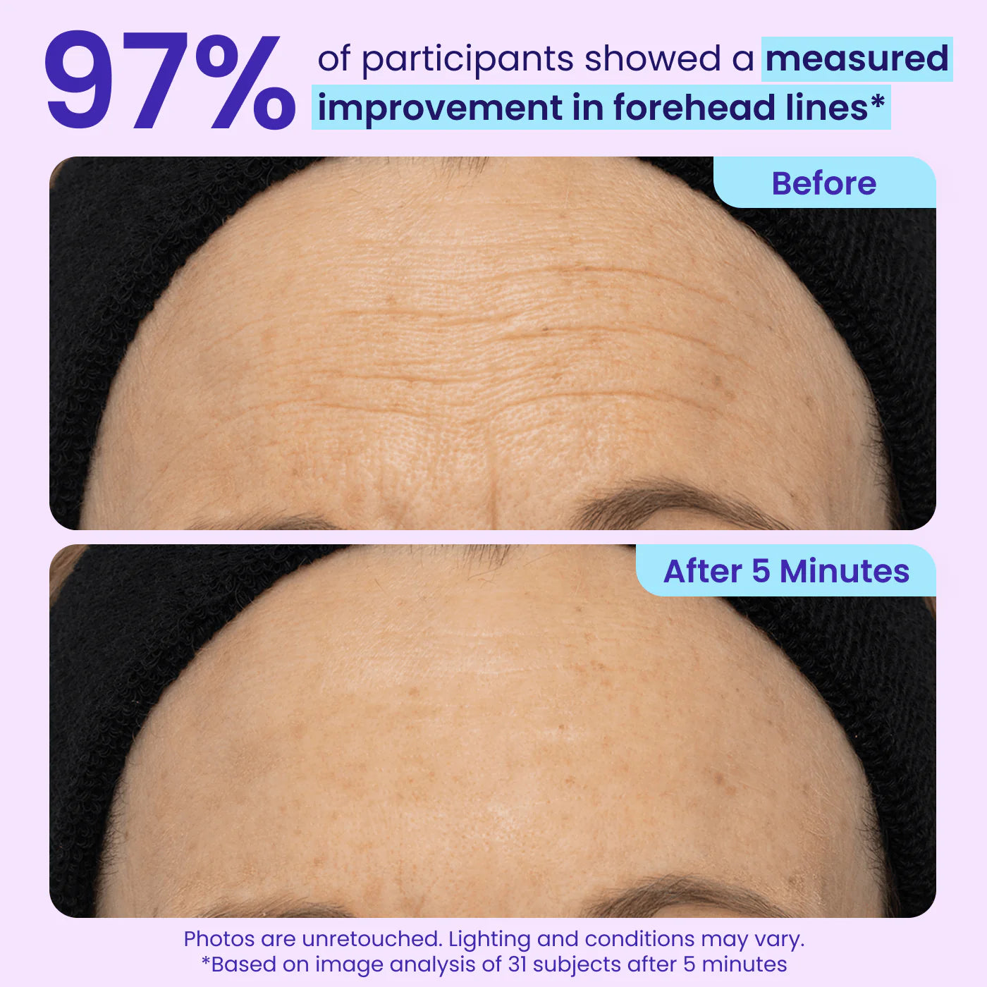 GOPURE | Gel Liftant Instantané pour les Yeux