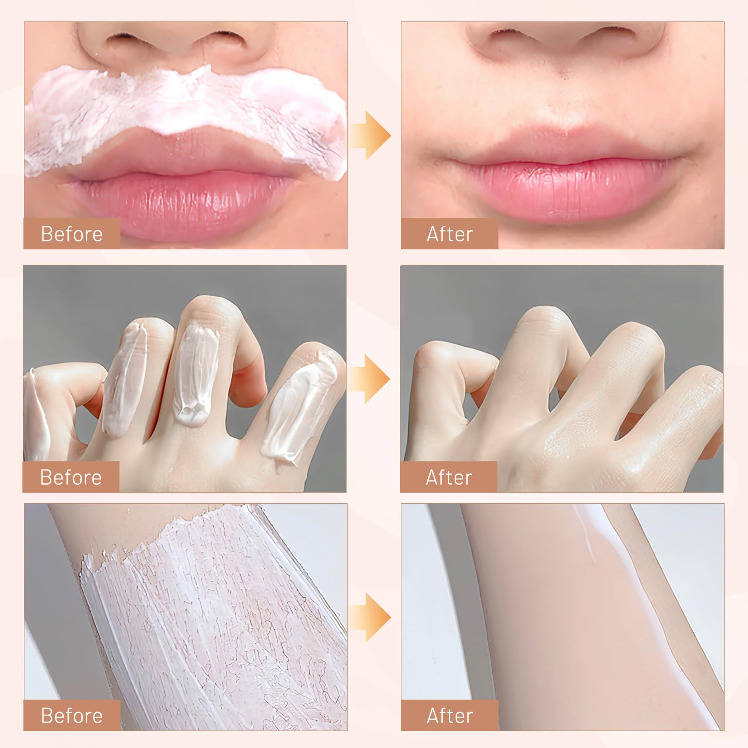 Nicor | Kit d'Épilation